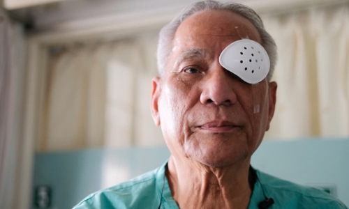 post cataract surgery