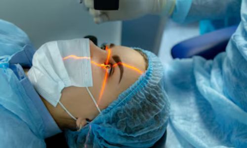 Refractive Laser Surgery