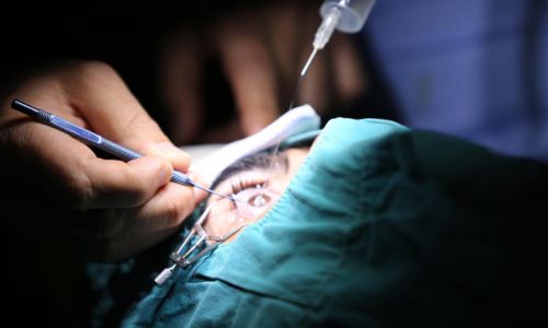 Squint Surgery